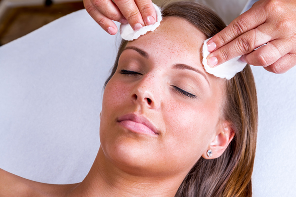 chemical peel for hyperpigmentation