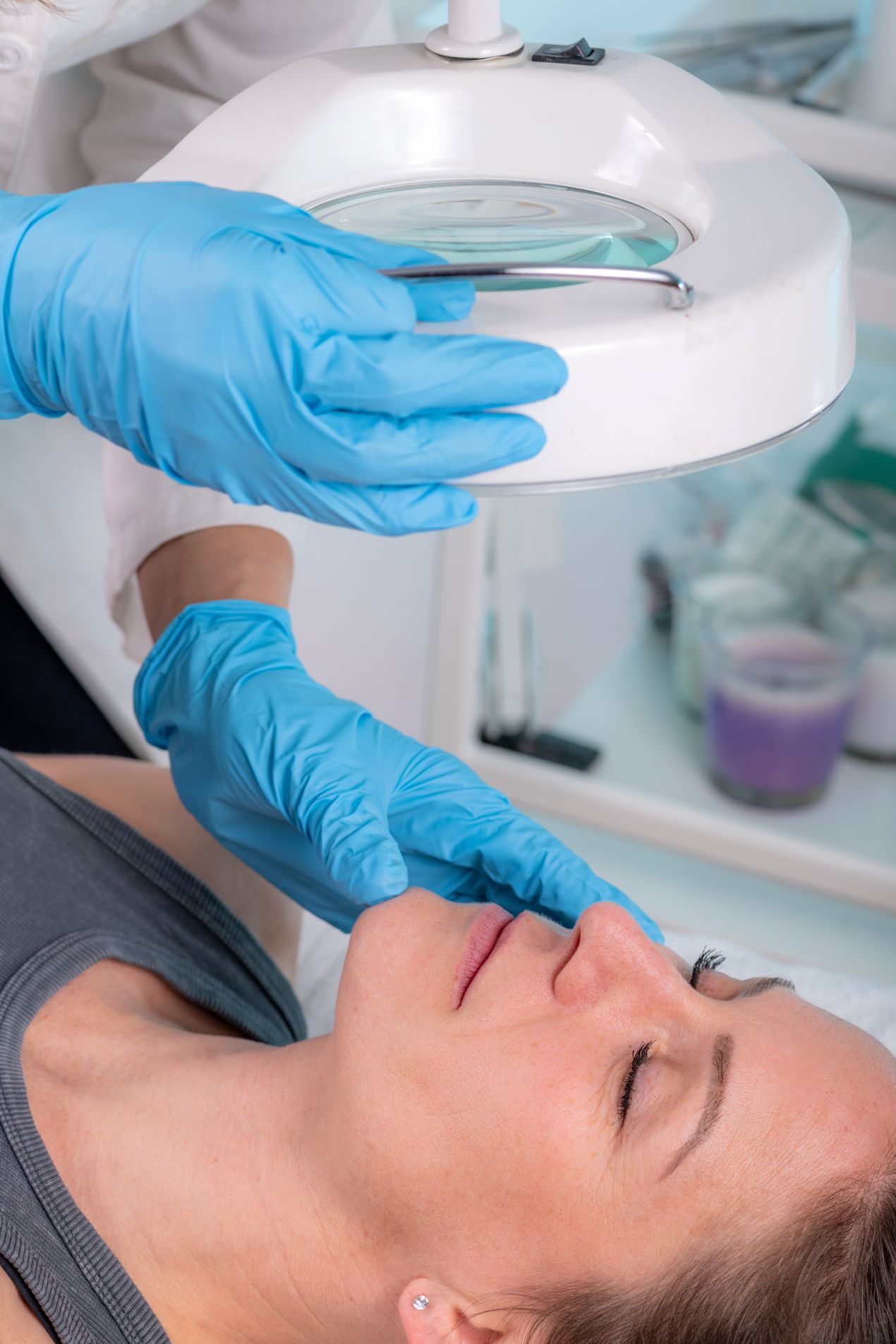 Acne Skin Clinic London