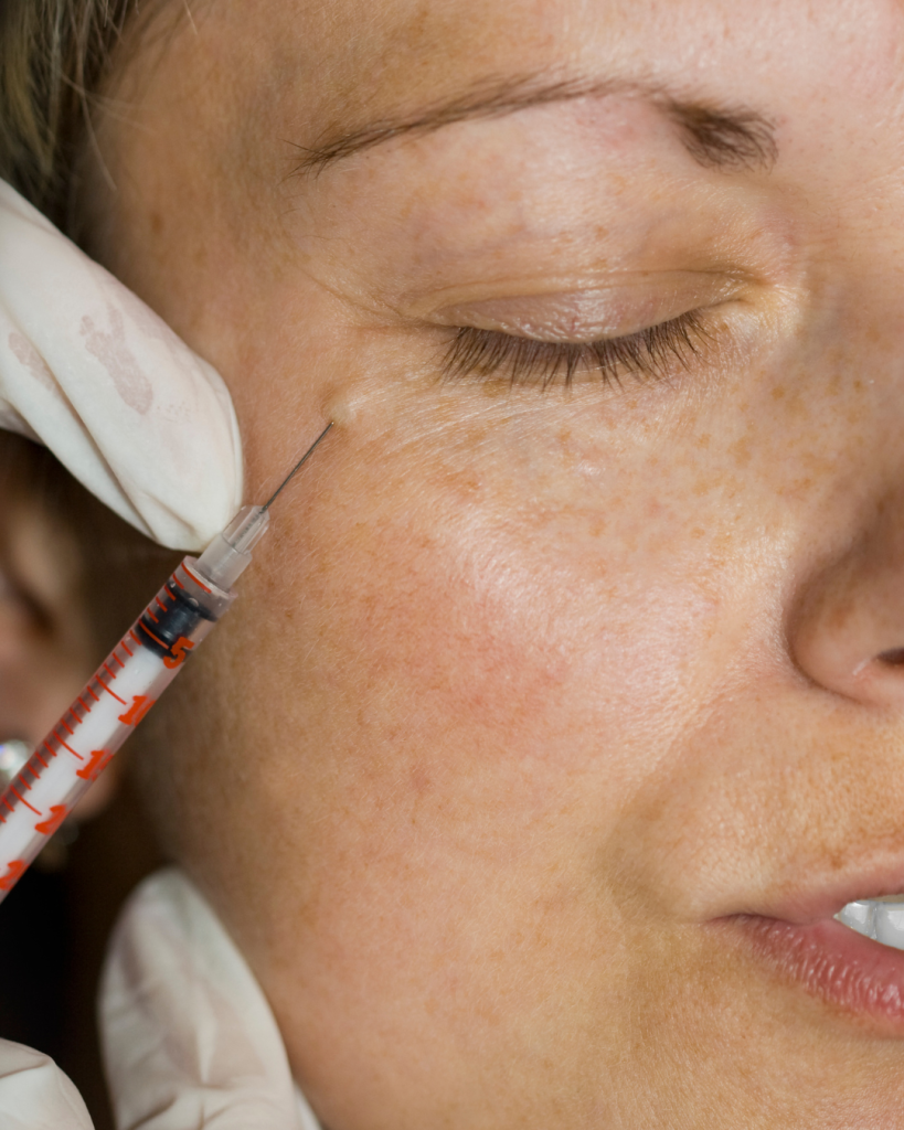 anti wrinkle treatment 1