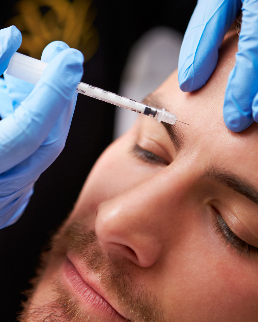 anti wrinkle treatment 2