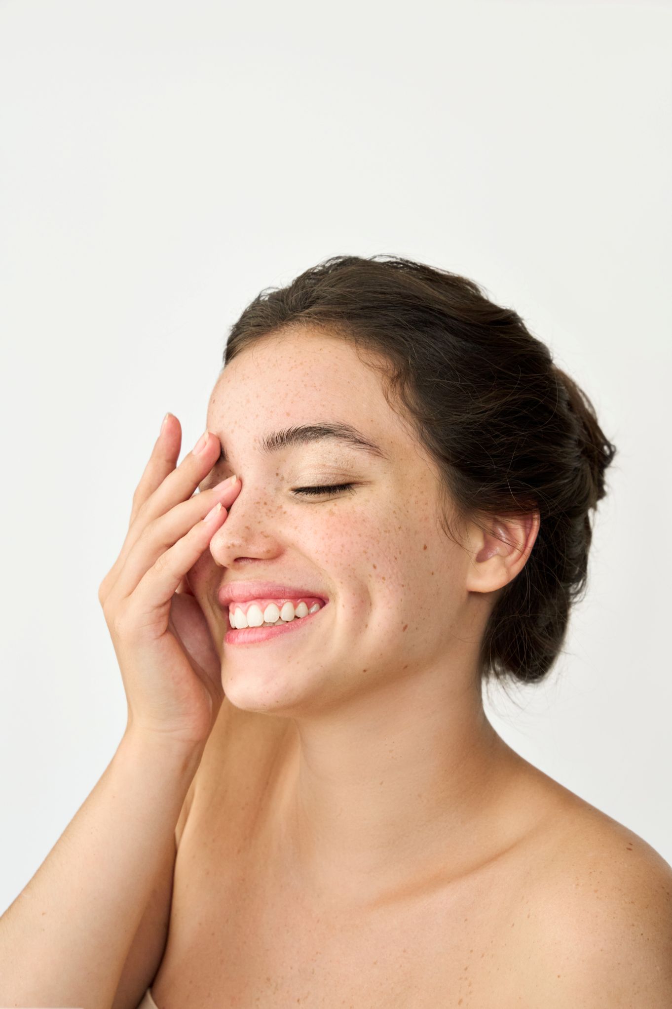 Chemical Peel Skin Clinic London 3