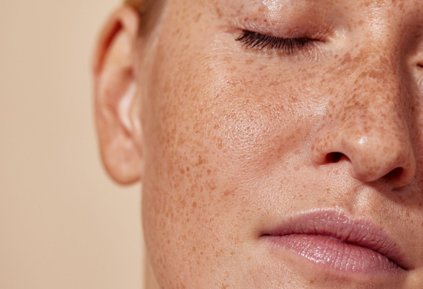 Dull dehydrated skin Skin Clinic London 3