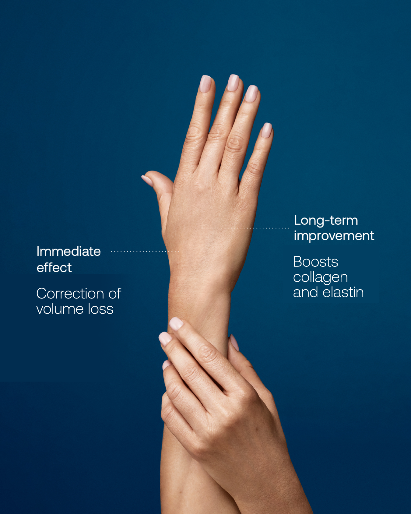 Hands 1