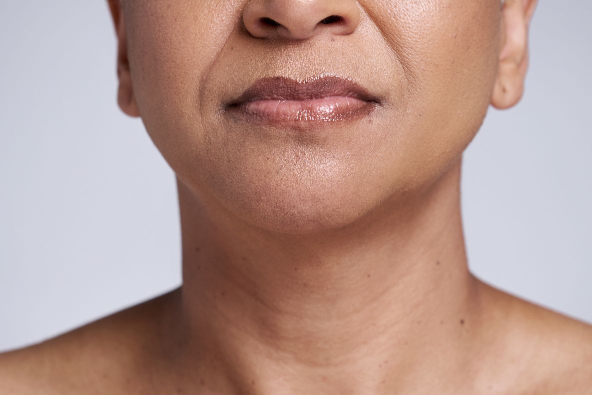 Neck and décolletage Skin Clinic London 1