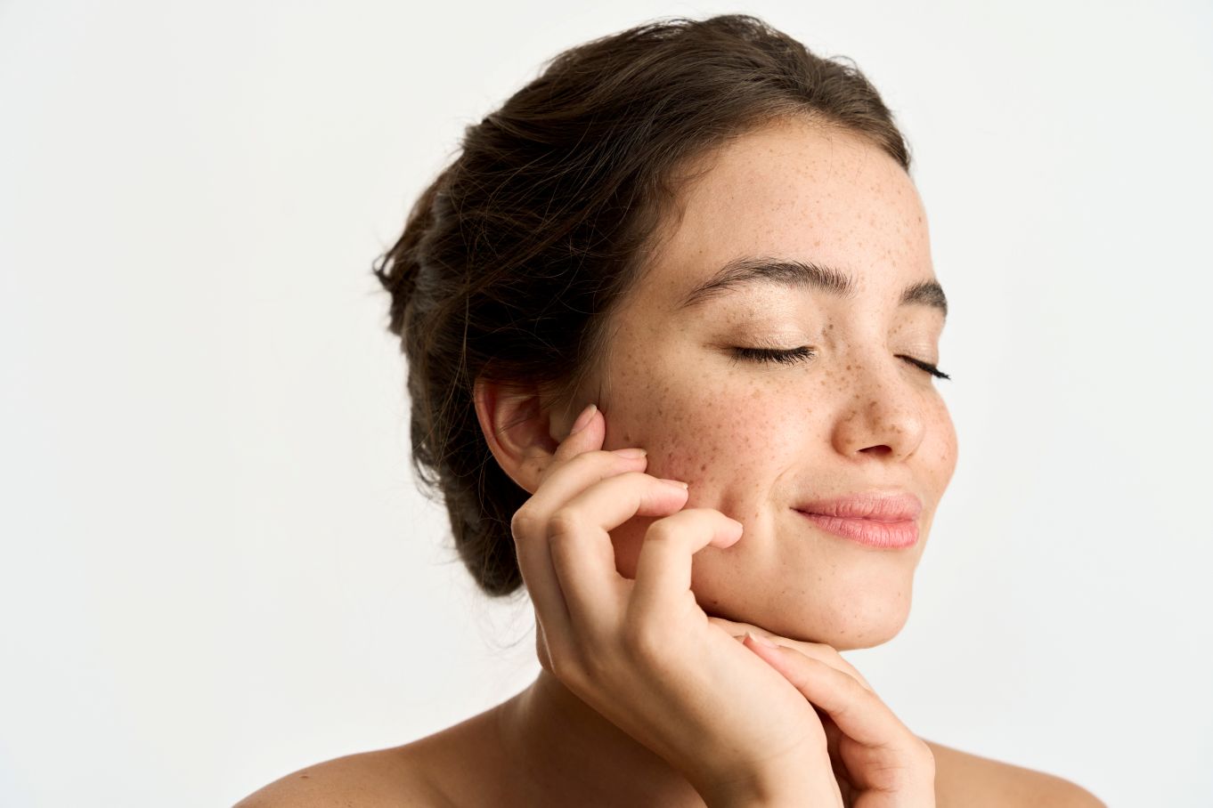 Profhilo Skin Clinic London