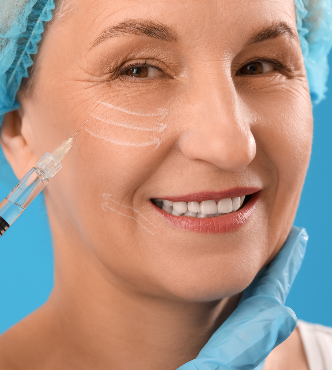 dermal fillers treatment overview 1