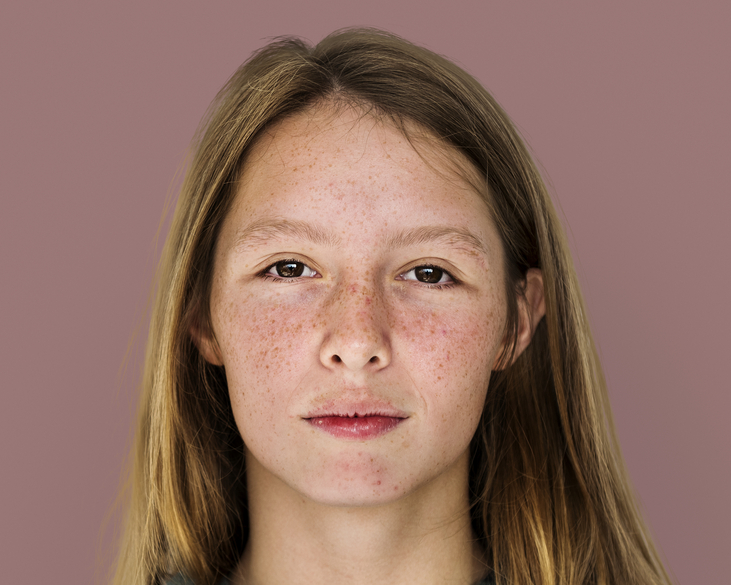 freckled girl face portrait natural beauty concept