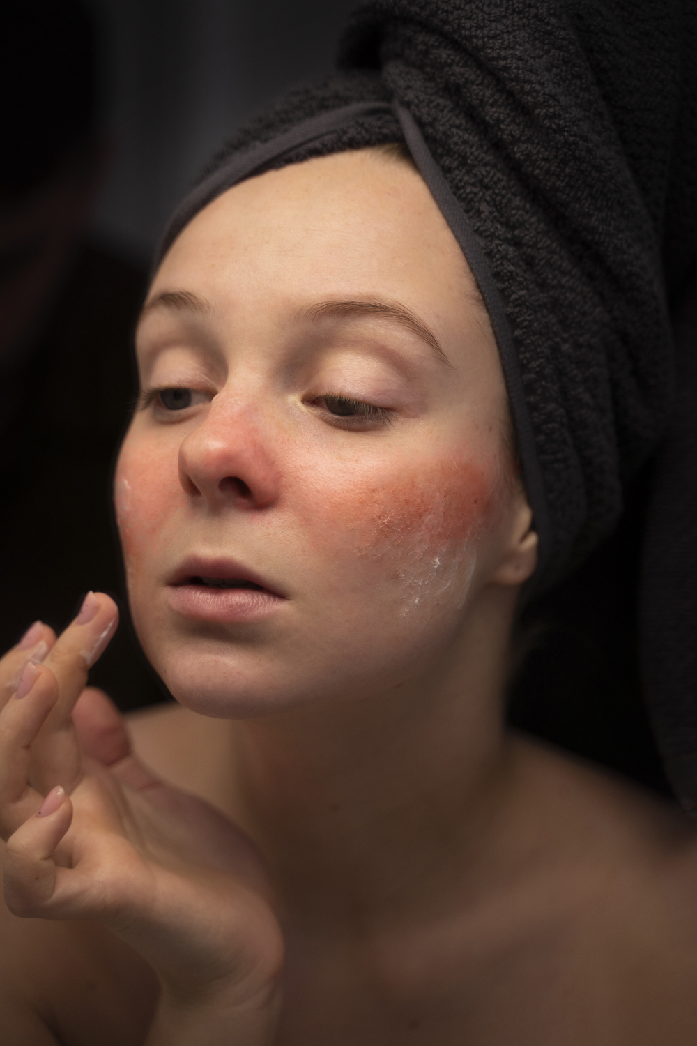 woman looking her rosacea mirror